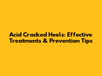 Acid Cracked Heels: Effective Treatments & Prevention Tips