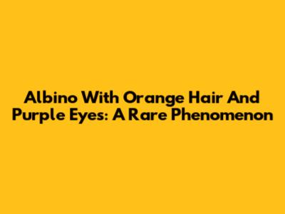 Albino With Orange Hair And Purple Eyes: A Rare Phenomenon